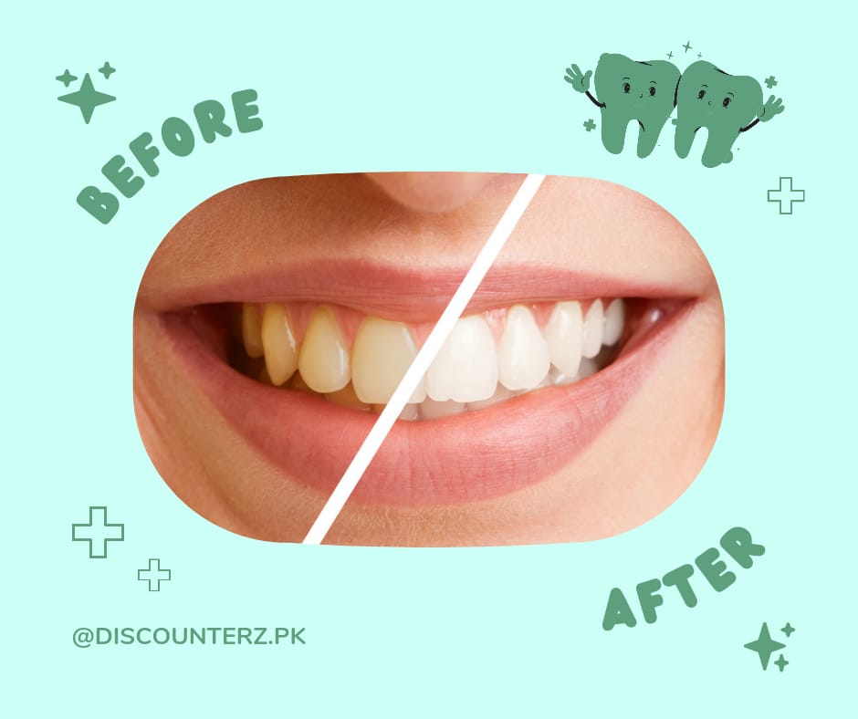 Discounterz Tooth Whitening Powder