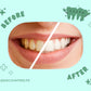 Discounterz Tooth Whitening Powder